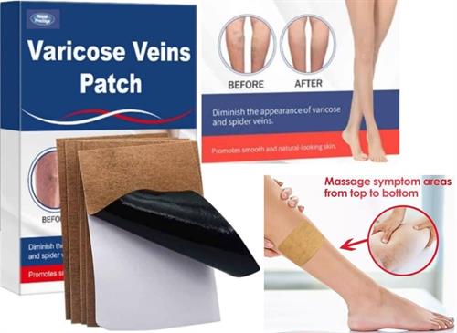 Varicose Vein Patch